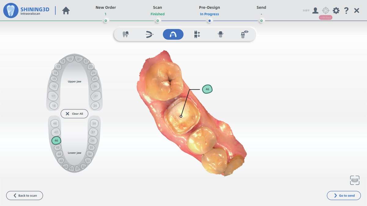 Shining 3D Intraoral Scanner OsseoDent™